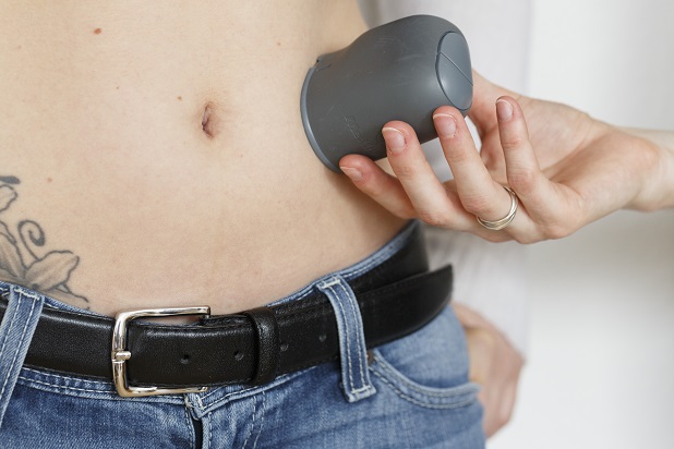 Kontinuierliche Glukosemessung (CGM)